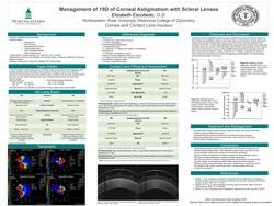 Management of 19D of Corneal Astigmatism with Scleral Lenses